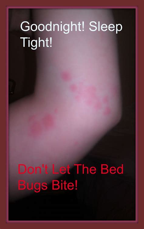 Bed Bug Removal Checklist Outline With Images Bed Bugs Bed Bug