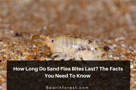 How Long Do Sand Flea Bites Last The Facts You Need To Know 2021