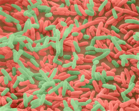 Coloured Sem Of Escherichia Coli Bacteria Stock Image B2300143