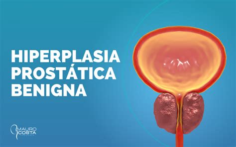 Hiperplasia Prostática Benigna Dr Mauro Costa