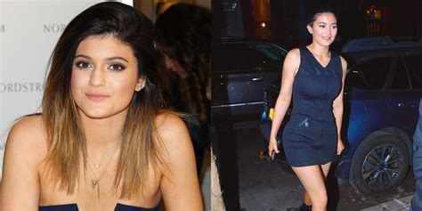 Kylie Jenner Without Lip Fillers Photos See Kylie S Natural Lips From Then To Now