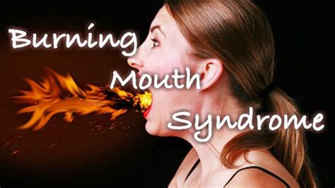 New Treatments For Burning Mouth Syndrome Burning Mouth Syndrome Burning Tongue Syndrome