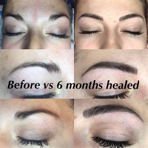 Bailey Before And After 6 Months Healed Microblading Aftercare