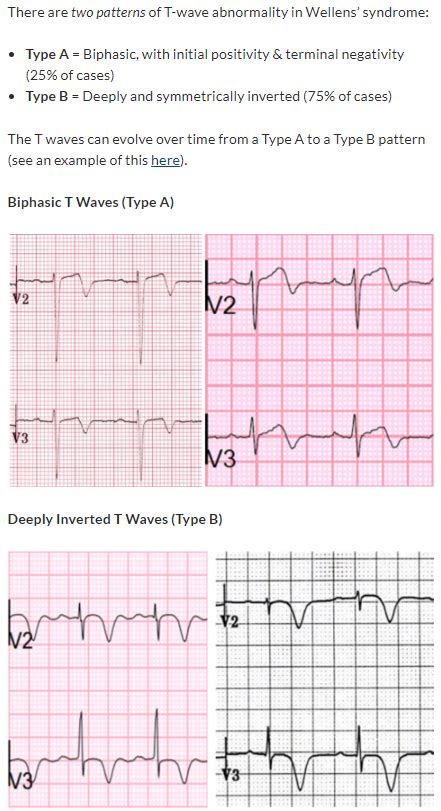 There Are Two Patterns Of T Wave Abnormality In Wellens Grepmed