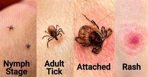 Looking for the definition of tic? Lyme Disease Risk in Oregon