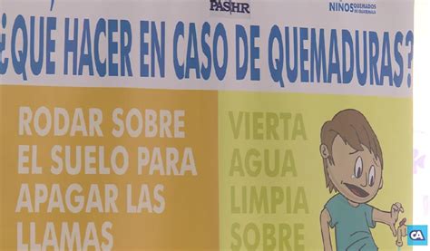 Hospital Roosevelt Llama A Prevenir Quemaduras En Niños Y Adolescentes