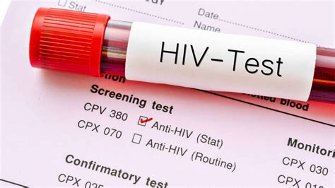 Major Hurdle For Hiv Positive Immigrants To Be Removed Nz