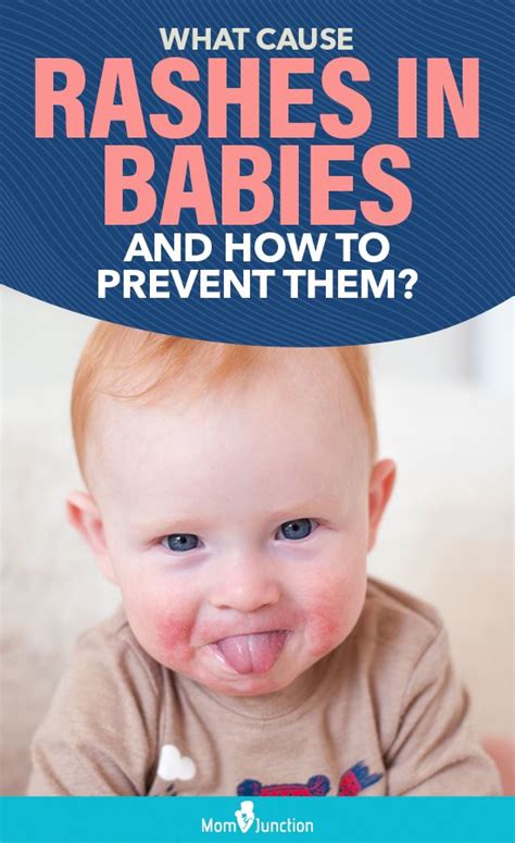 What Cause Rashes In Babies And How To Prevent Them