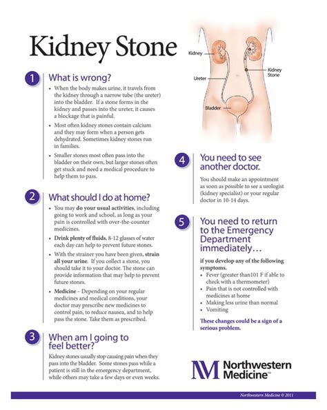Kidney Stone Pain Location Diagram Aflam Neeeak