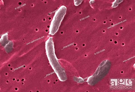 Scanning Electron Micrograph Sem Of Vibrio Cholerae Bacteria Stock