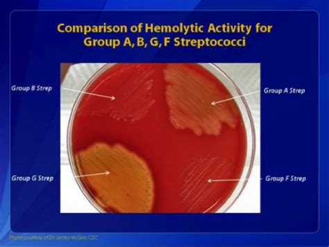 Streptococcus Group B Statpearls Ncbi Bookshelf