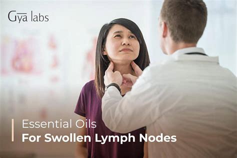 Top 10 Essential Oils For Swollen Lymph Nodes Recipes Included