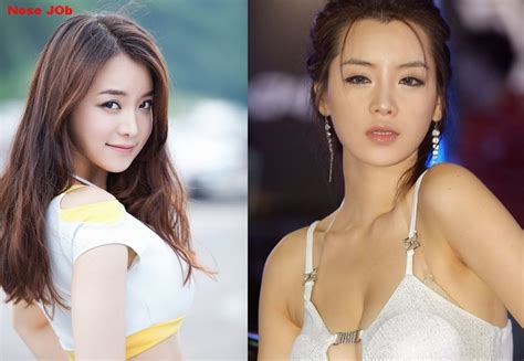 Asian Celebrities Plastic Surgery Before And After Pictures