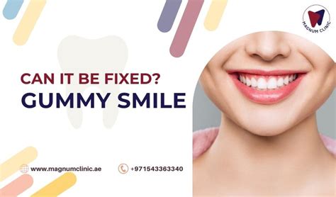 How To Fix A Gummy Smile Causes Types Treatment And Cost