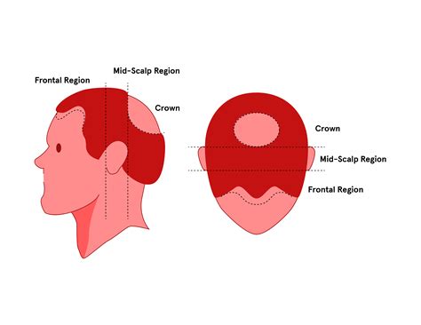 The 4 Regions Of The Scalp Keeps