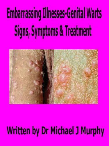 Embarrassing Illnesses Genital Warts Signs Symptoms And Treatments Ebook Murphy Dr
