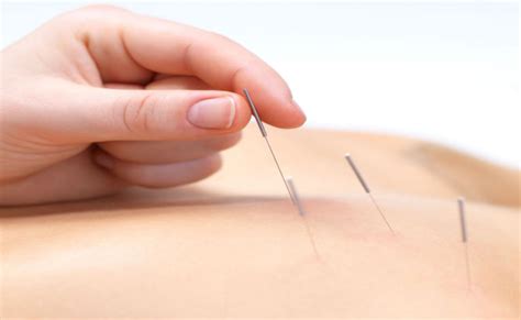 Acupuncture Yan Acupuncture And Herbs Gainesville Fl