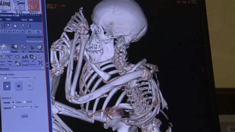 Virtual Autopsy Reveals Mummy Was Stabbed Ctv News