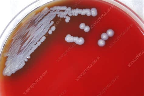Burkholderia Pseudomallei Bacteria Stock Image C0563542 Science