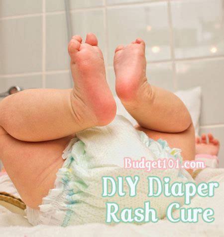 How To Treat Diaper Rash Overnight