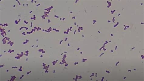 Gram Positive Cocci Gpc Introduction And List Of Bacteria Key