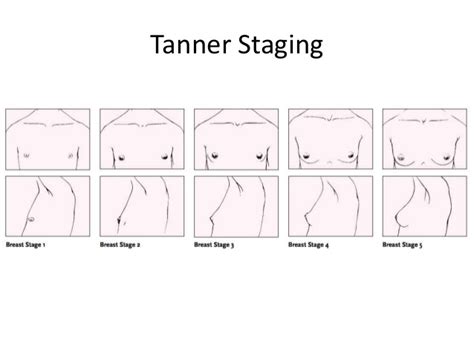 Limitations Of Tanner Sexual Developmental Stages For Women Shitty Advice