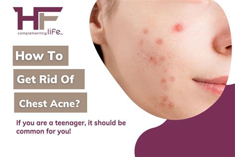 How To Get Rid Of Chest Acne Healthfinder