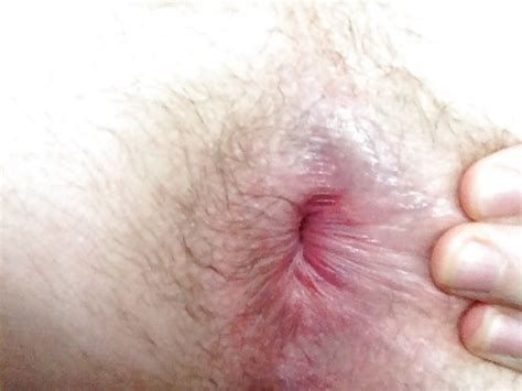 Male Butthole Close Ups 29 Pics Xhamster