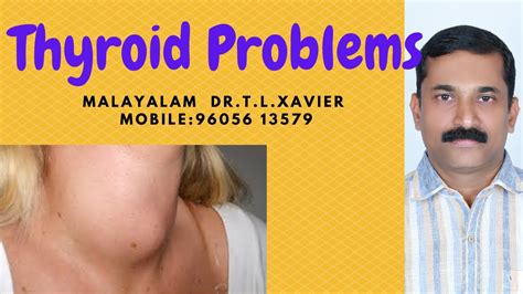 Thyroid Diseases Hypo Thyroid Hyper Thyroid Goiter Ayurveda View