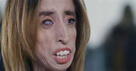Lizzie Velásquez Discusses Fighting Bullying Attn