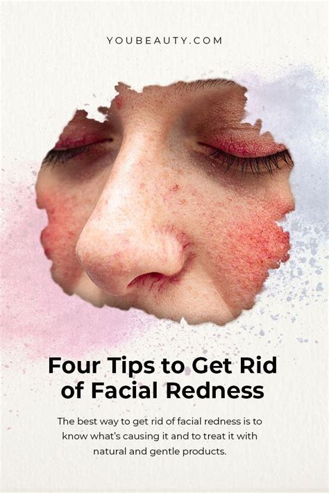 Four Tips To Get Rid Of Facial Redness Red Irritated Skin Skin