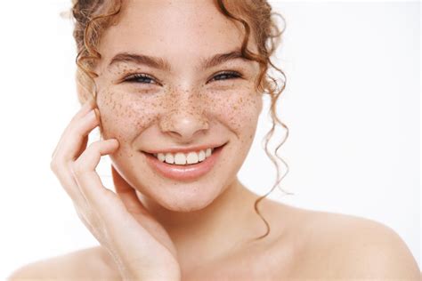 Moles Vs Freckles Whats The Difference Western Maryland Dermatology