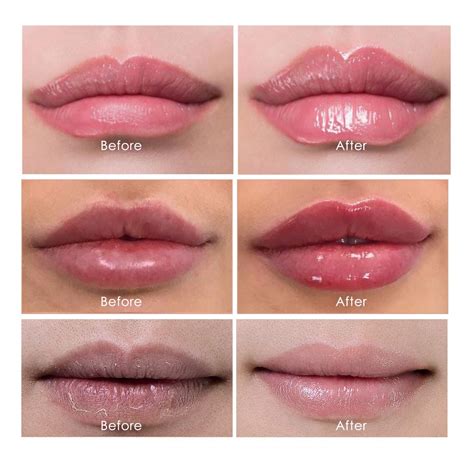Before And After Lip Plumper Gloss Ubicaciondepersonascdmxgobmx