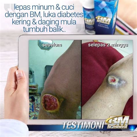 Terdapat banyak cara yang anda boleh gunakan untuk melawan kanser. Penawar Kencing Manis Paling Mujarab - Lottepi.com ...