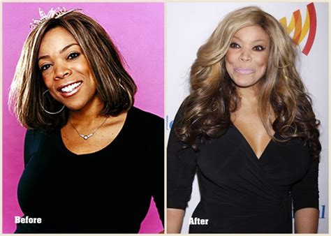 Wendy Williams Plastic Surgery Before And After Photo Celebrity