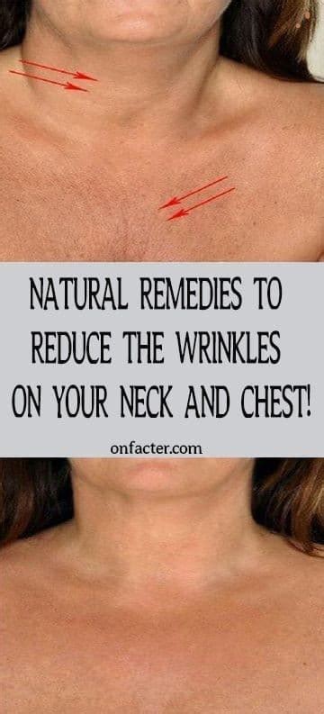 Natural Remedies To Reduce The Wrinkles On Your Neck And Chest Skin
