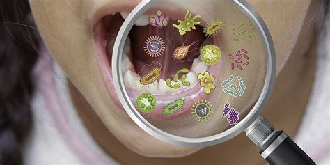 Increase The Good Bacteria In Your Mouth With Dental Probiotics — The