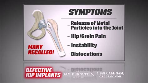 Defective Hip Implant Recall Youtube