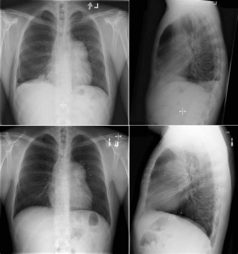 Radiographic Findings By Diagnosis Congenital Abnormalities And