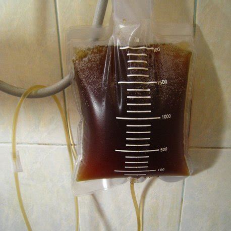 Who is max gerson and what is gerson therapy? La cure Gerson, une cure de jus de légumes et de fruits
