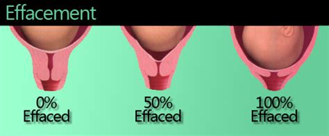 Many women hang out at home during this opening act. Effacement and Dilation Explained Pregnancy Families.com
