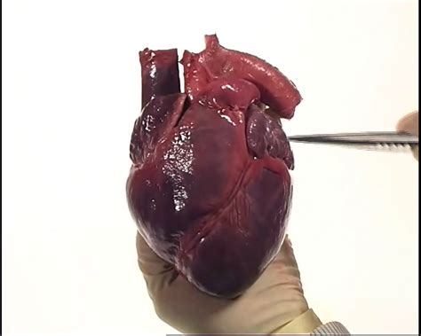 Anatomy Of Heart Video