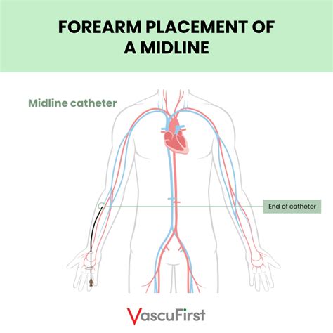 Picc Line Catheter