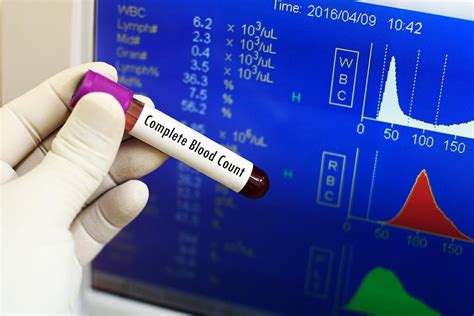 Platelets High And Low Count Normal Range Selfdecode Labs