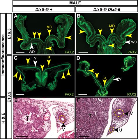 Frontiers Distal less homeobox genes Dlx5 6 regulate Müllerian duct