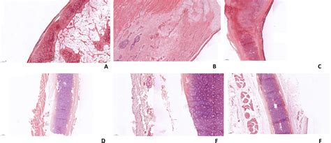 Histopathological Examination Of Laryngeal Tissue In Group Iii A