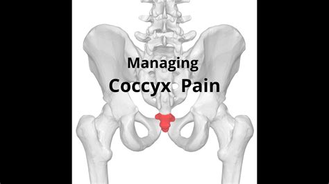 Coccyx Pain Relief Youtube