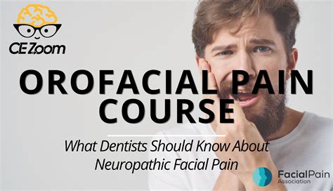 Ss What Dentists Should Know About Neuropathic Facial Pain