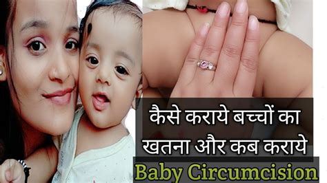 Babycare Babyvideo Baby Circumcision बच्चों का खतना कैसे कराये