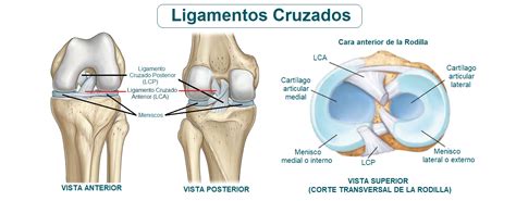 rotura de ligamentos cruzados qué es causas síntomas tratamiento y consejos fisioonline